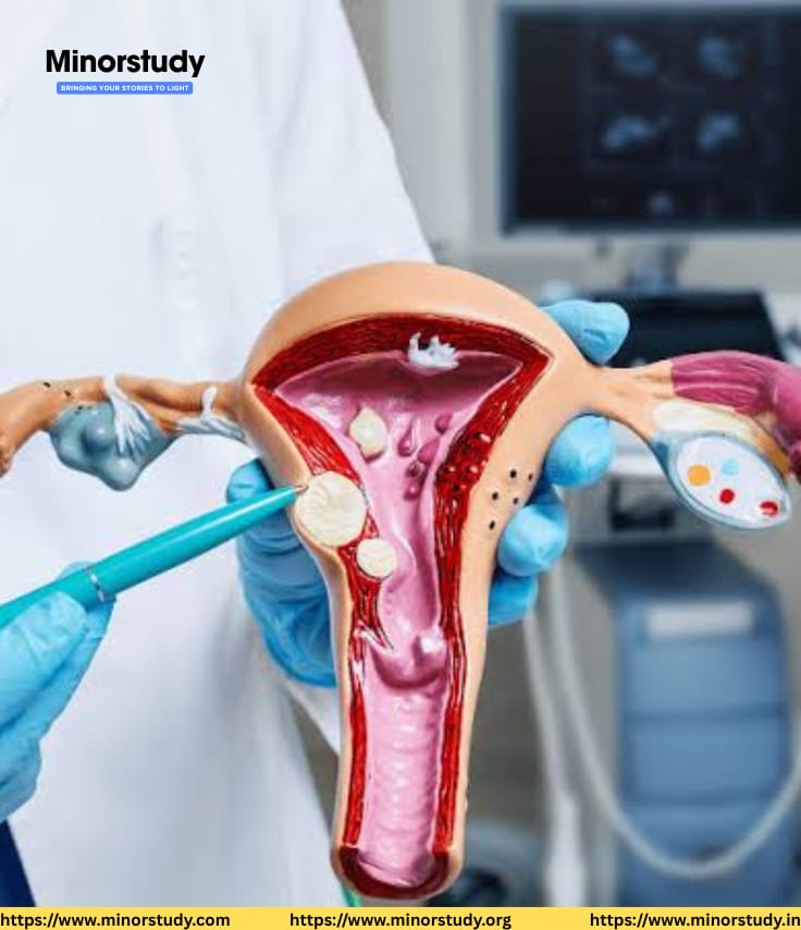 Gynecology