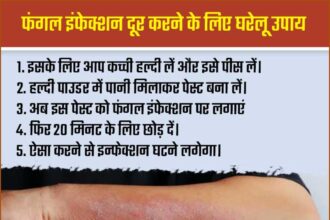 Fungal Infections