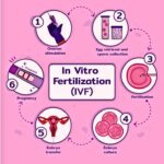 IVF