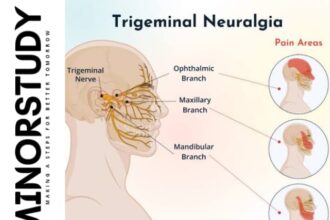 Trigeminal Neuralgia