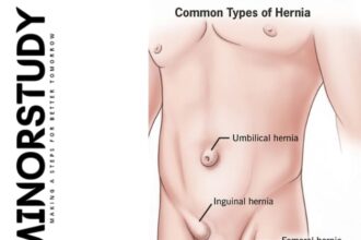 hernia