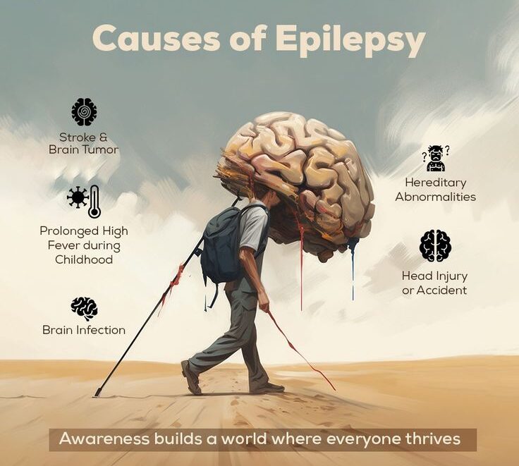 International Epilepsy Day